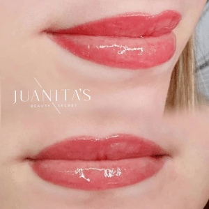 juanitas lip treatments