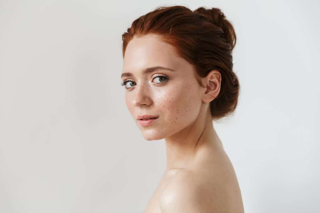 model with freckles
