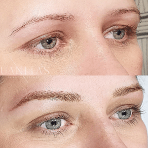 treatment for brows