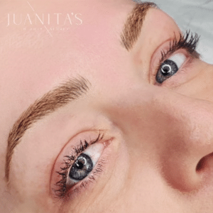 brow before after