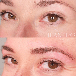 brow before after 2