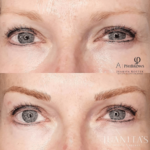 brow before after juanita